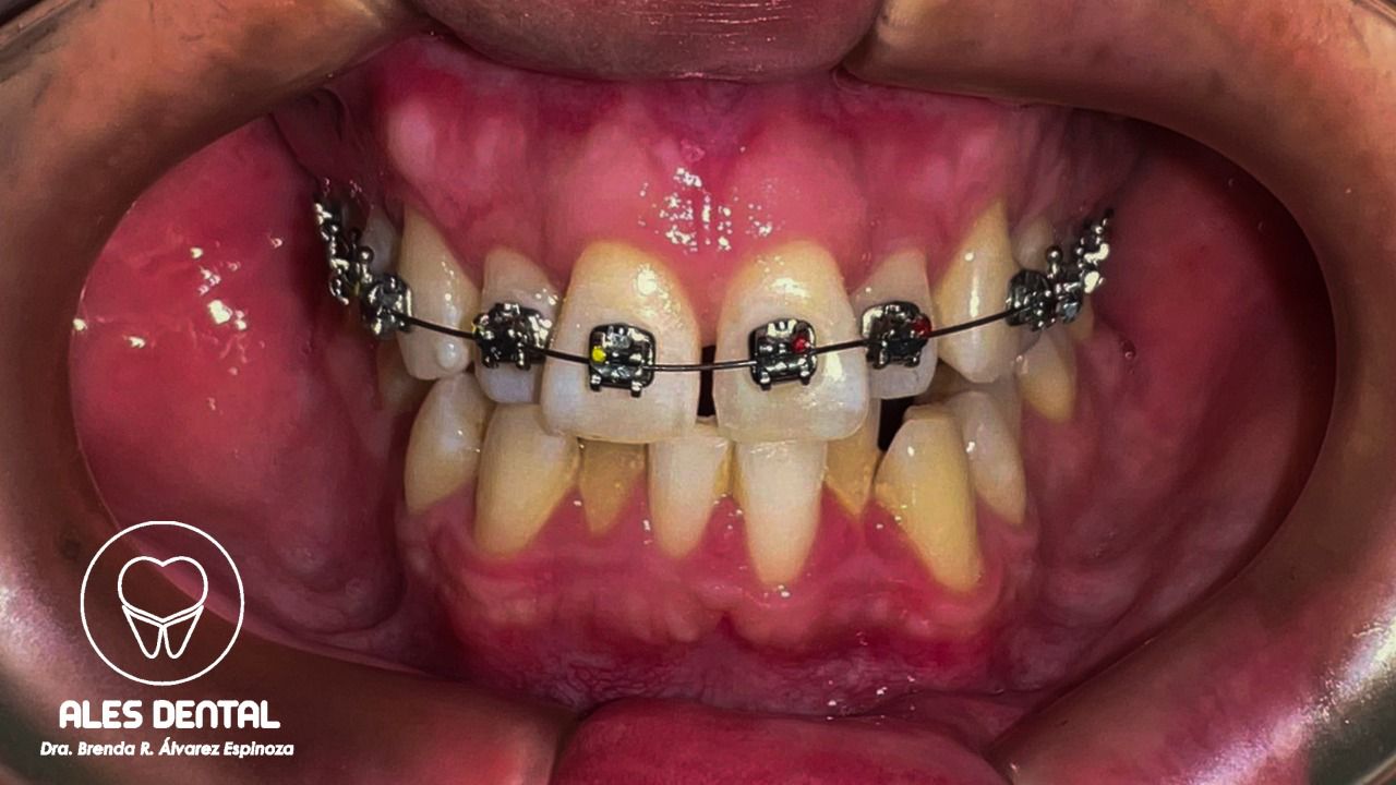 Odontopediatría Ales Dental