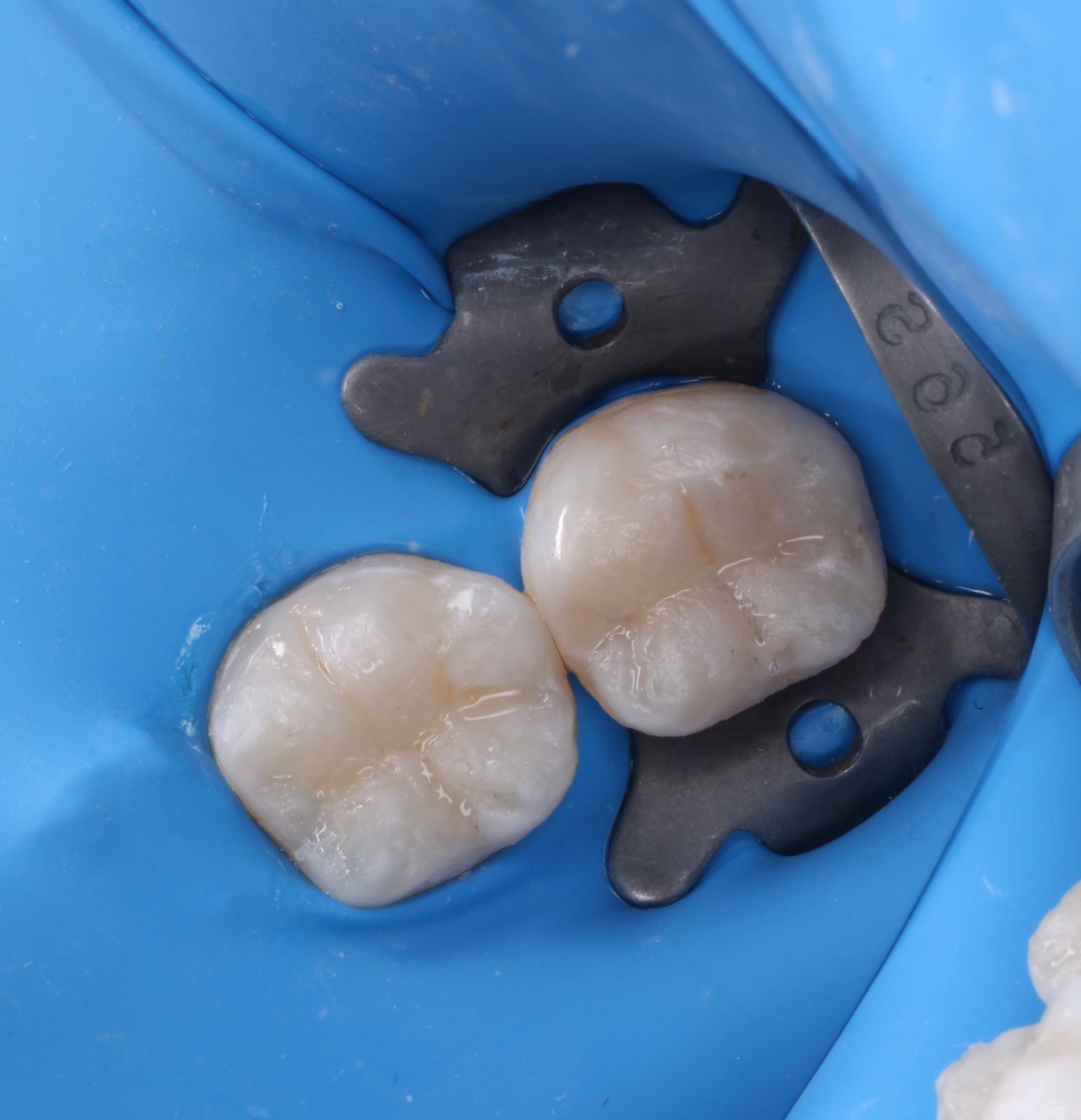 Clínica Ales Dental en Tijuana